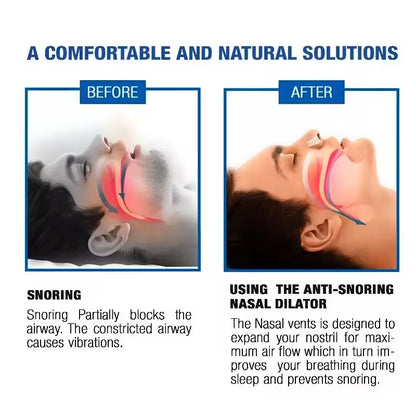 Anti-Snoring Nose Clip