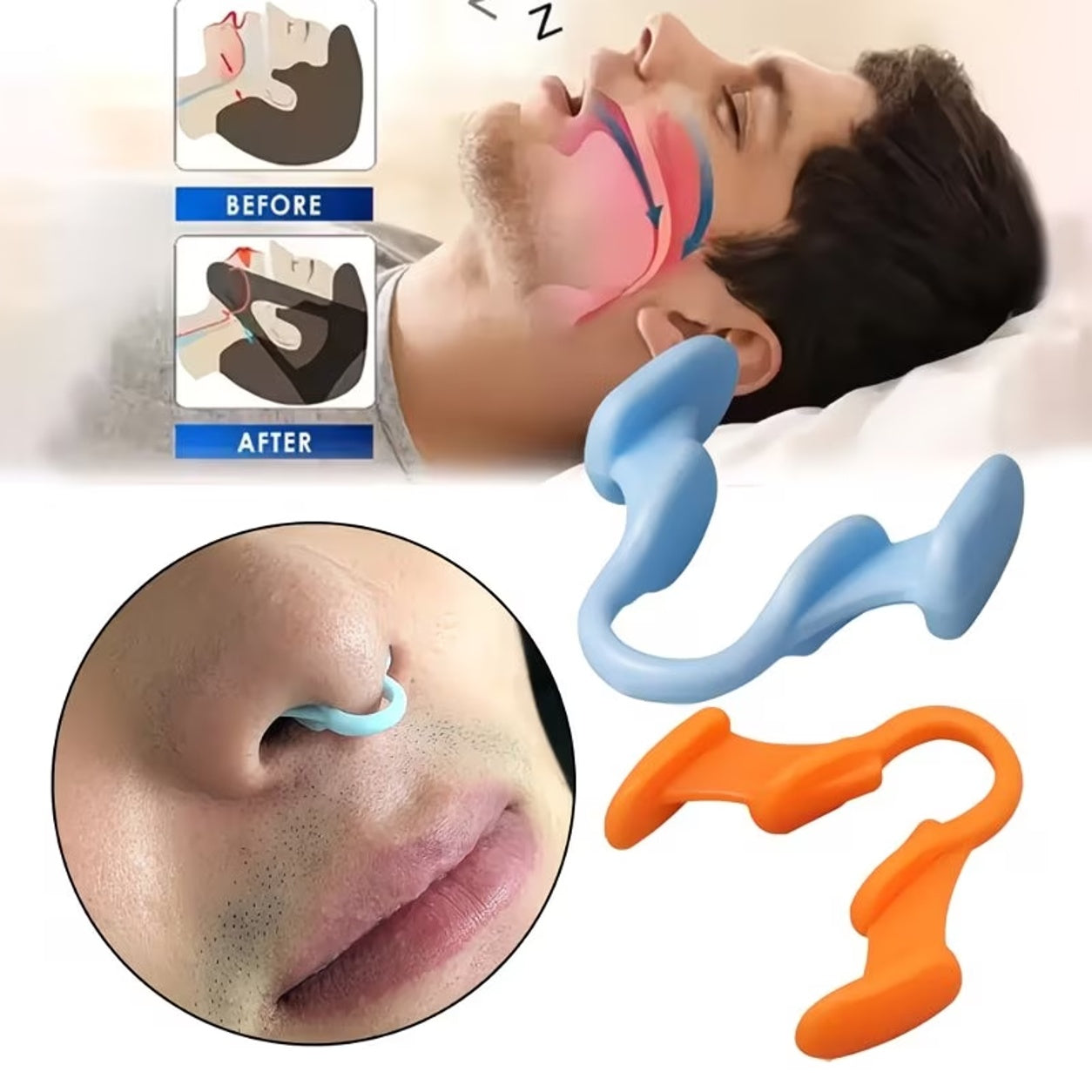 Anti-snoring Device Comfortable Adjustable Nasal Aid